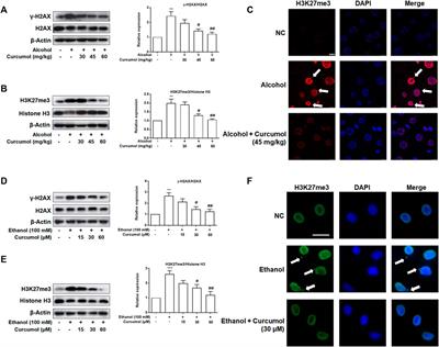 Curcumol Suppresses CCF-Mediated Hepatocyte Senescence Through Blocking LC3B–Lamin B1 Interaction in Alcoholic Fatty Liver Disease